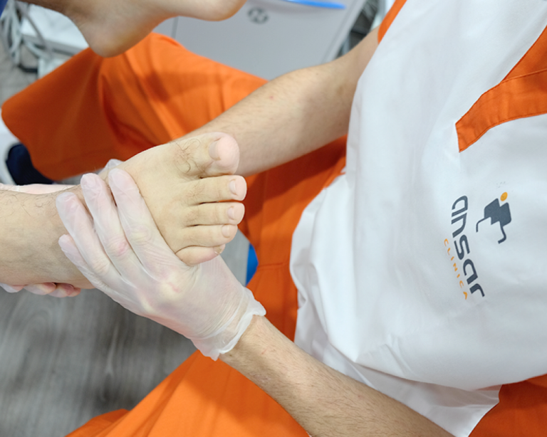 Lee más sobre el artículo TENDINOPATÍAS Y SU TRATAMIENTO. EPTE