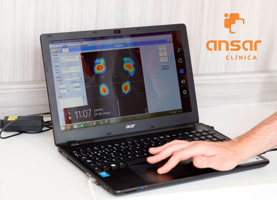 Clínica Multidisciplinar Ansar Estudio Biomecánico